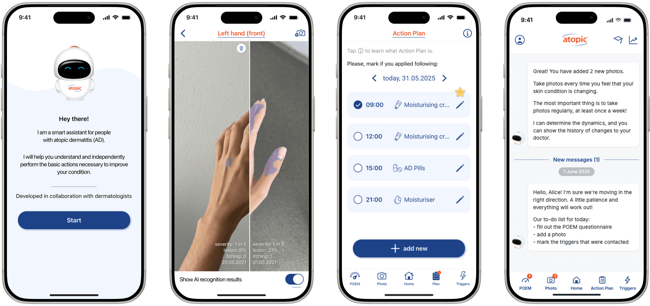 Atopic App screens: guided assistant, photo analysis, action plan and assistant chat